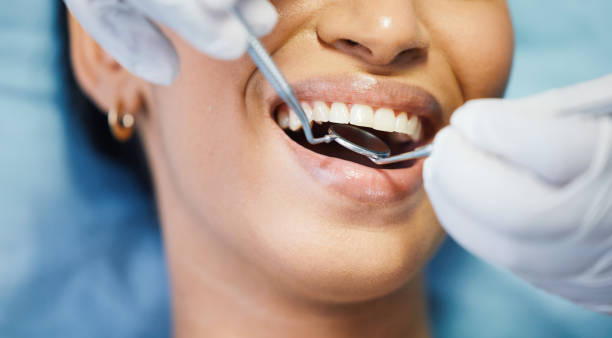 Best Teeth Whitening  in Van Buren, AR