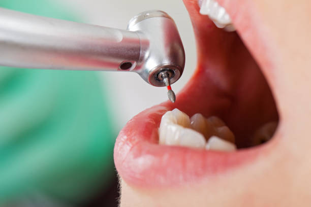 Best Root Canal Emergency Dentist  in Van Buren, AR